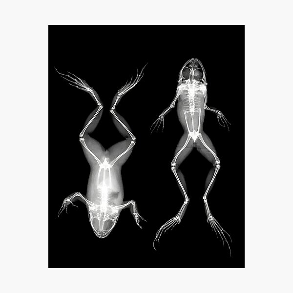 Item preview, Frogs in Prone and Supine Positions (Frösche in Bauch- und Rückenlage) designed and sold by The Ravens Ballad.