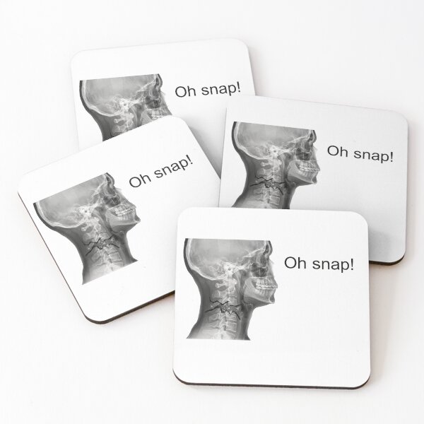 Item preview, Oh snap! designed and sold by Probably Fine.
