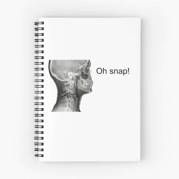 Item preview, Oh snap! designed and sold by Probably Fine.