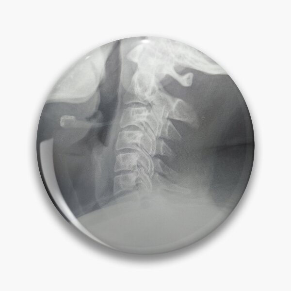 Item preview, Neck X-ray  designed and sold by itsash95.