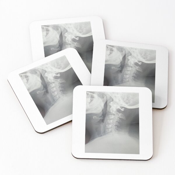 Item preview, Neck X-ray  designed and sold by itsash95.