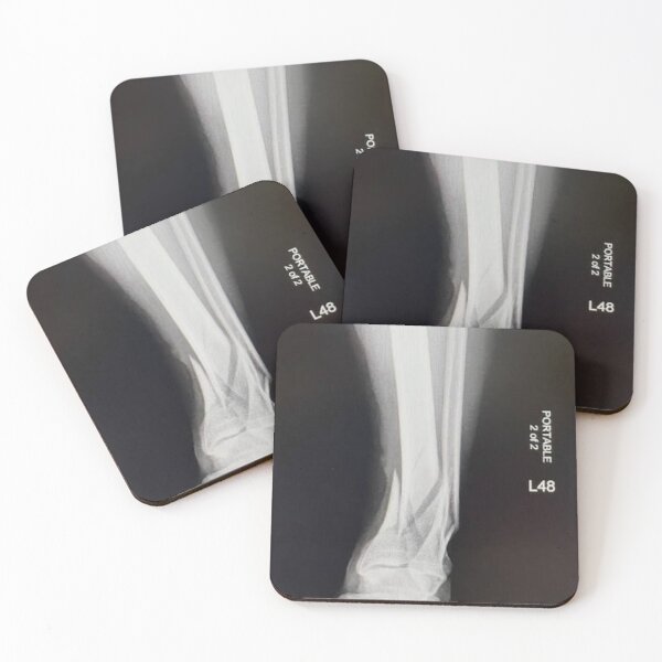 Item preview, Billy X-Ray designed and sold by FlodownGoods.