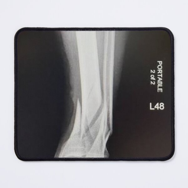 Item preview, Billy X-Ray designed and sold by FlodownGoods.