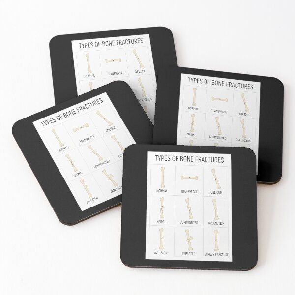 Item preview, Hand Drawn Types of Fractures designed and sold by Shopun.