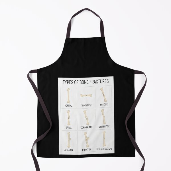 Item preview, Hand Drawn Types of Fractures designed and sold by Shopun.