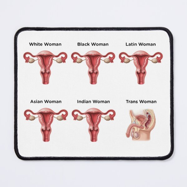 Item preview, Uterus of the World designed and sold by Free HUMAN Speech is essential..
