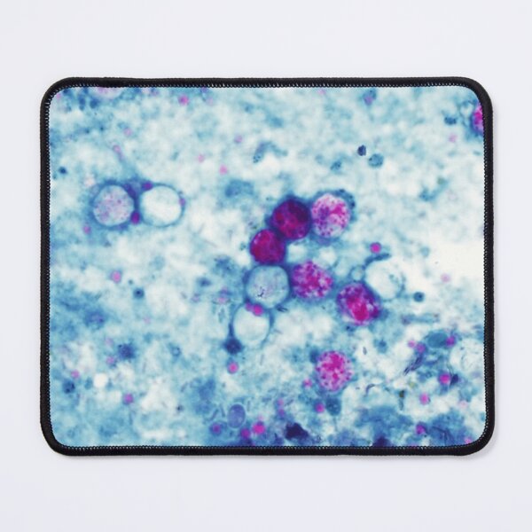 Item preview, Cyclospora Cayetanensis Microscopic Parasite Science designed and sold by teemix.