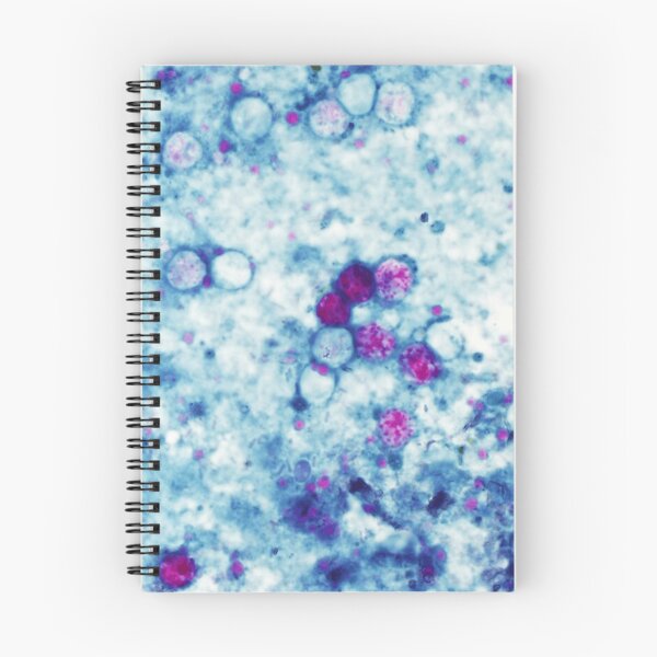 Item preview, Cyclospora Cayetanensis Microscopic Parasite Science designed and sold by teemix.