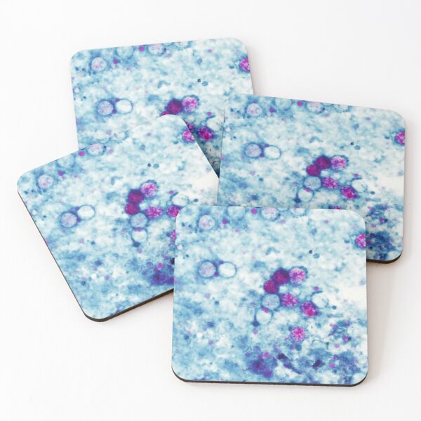 Item preview, Cyclospora Cayetanensis Microscopic Parasite Science designed and sold by teemix.