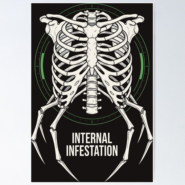 Aperçu de l'œuvre Infestation interne - Graphique Cyberpunk Techwear Dark Anatomy créée et vendue par SplashTastic.