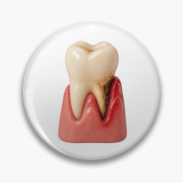 Item preview, Gum Pocket and Tooth Decay – Periodontal Pocket and Root Caries Medical Illustration  S designed and sold by RokaCircles.