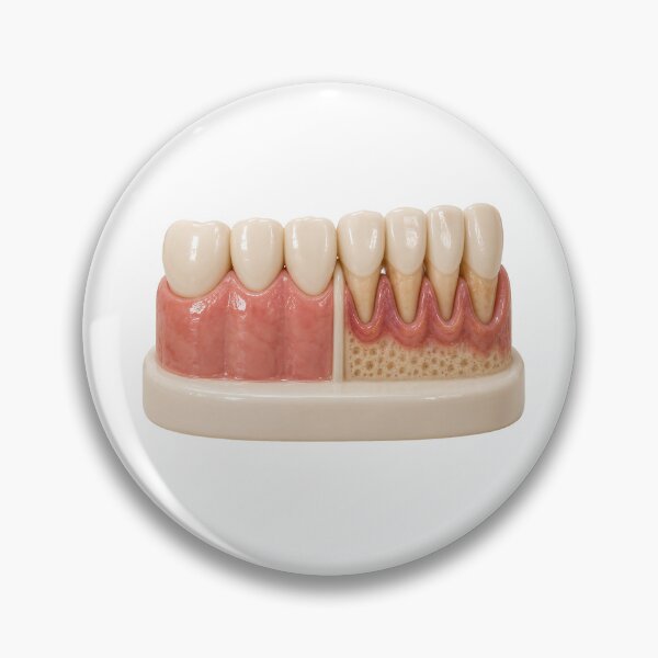 Item preview, Healthy Gums vs Gum Recession and Periodontal Disease – Dental Bone Loss Comparison designed and sold by RokaCircles.