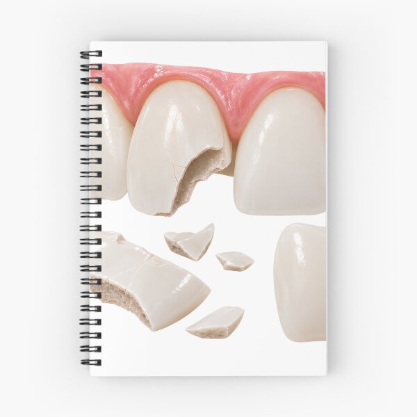 Item preview, 3d Broken and Damaged Teeth with Enamel Fracture and Dental Restoration Concept designed and sold by RokaCircles.