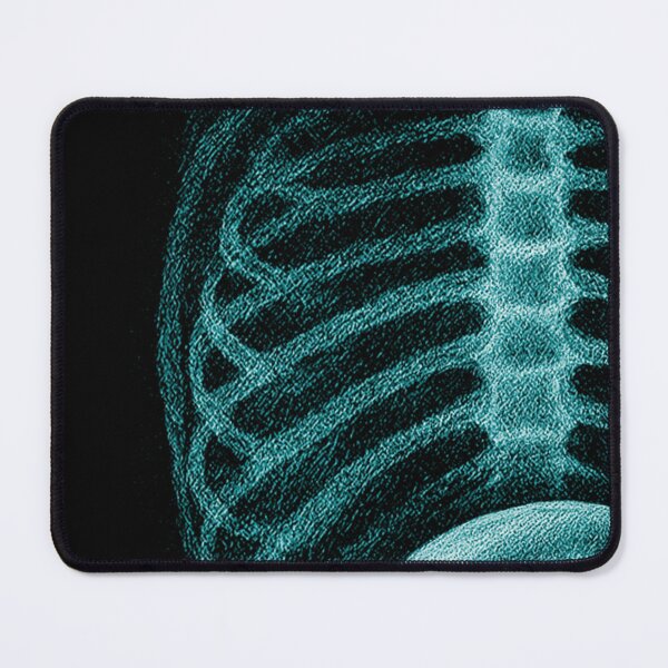 Item preview, Alien Radiography Alien X-Ray designed and sold by dyneskissern.