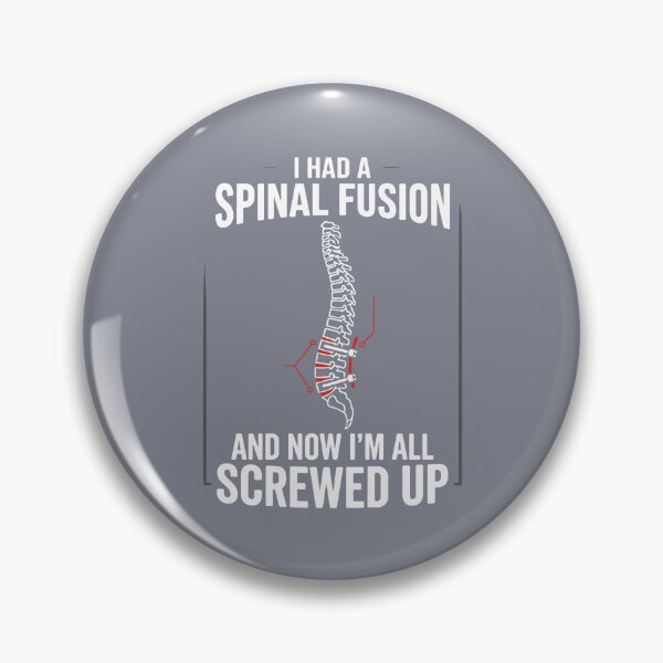 Item preview, I Had A Spinal Fusion And Now I'm All Screwed Up Spinal Surgery Patient Humor designed and sold by SofiBlair.
