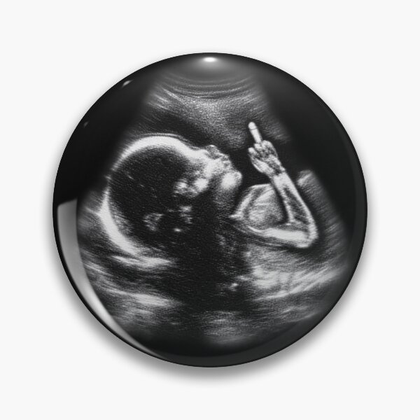 Item preview, Baby Ultrasound - Funny Classic T-shirt designed and sold by TOLDWAYTSHIRT.