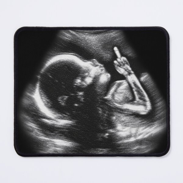 Item preview, Baby Ultrasound - Funny Classic T-shirt designed and sold by TOLDWAYTSHIRT.