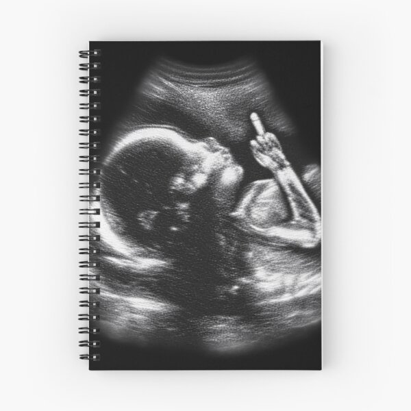 Item preview, Baby Ultrasound - Funny Classic T-shirt designed and sold by TOLDWAYTSHIRT.