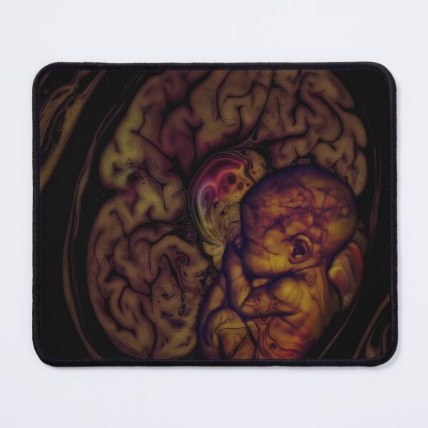 Item preview, Fetus Curled Within a Human Brain designed and sold by MongLongStudio.