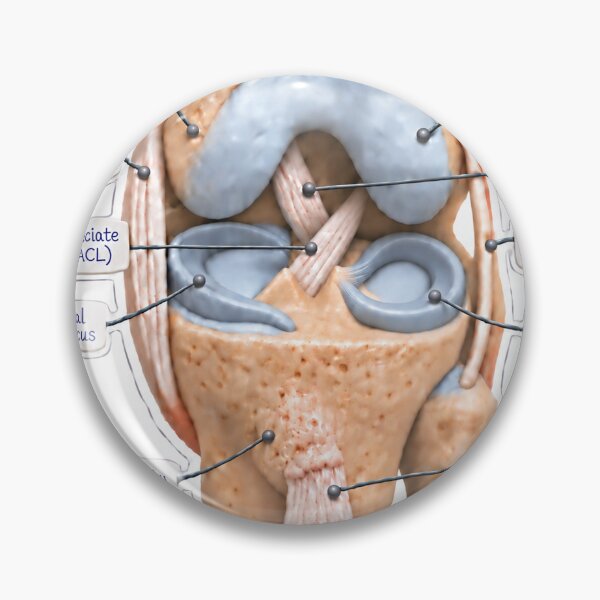 Item preview, Pegatina de fisioterapia con animación en plastilina de la anatomía de la articulación de la rodilla designed and sold by isokinetic.