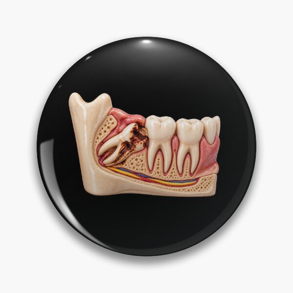 Item preview, Impacted Wisdom Tooth and Dental Anatomy Cross Section with Jaw Bone, Gums, Nerves and Teeth designed and sold by RokaCircles.