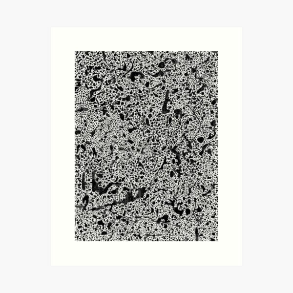 Gold Foil Wall Art FEAR OF collection 8x10 Fear of Holes Art TRYPOPHOBIA Art Gift Foil Painting