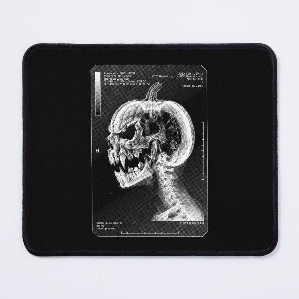 Item preview, Radiology Nurse Radiologist Halloween Pumpkin Skull X-Ray designed and sold by GrandeDuc.