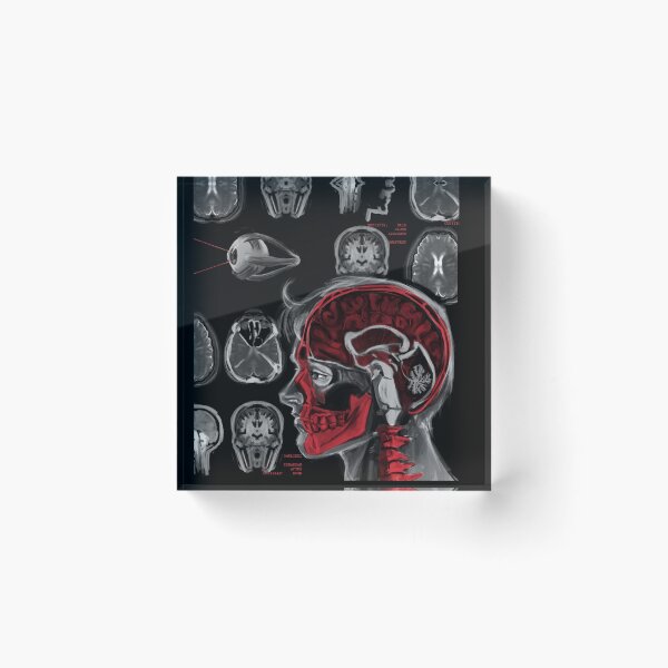 Item preview, encephalitis designed and sold by Cartastraccia.
