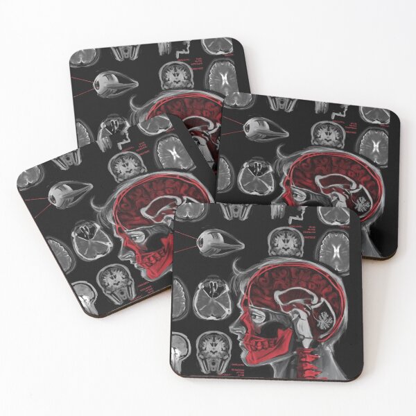 Item preview, encephalitis designed and sold by Cartastraccia.