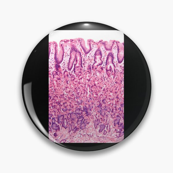 Item preview, Stomach-Histology designed and sold by tappaslo.