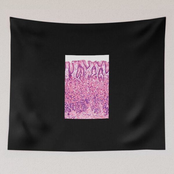 Item preview, Stomach-Histology designed and sold by tappaslo.