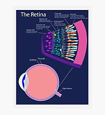 The Retina Photographic Print