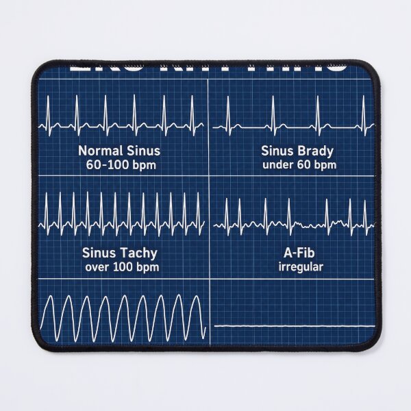 Artikelvorschau, EKG-Rhythmen – Lernhilfe für Krankenpflegeschüler (Aufkleber) entworfen und verkauft von isokinetic.