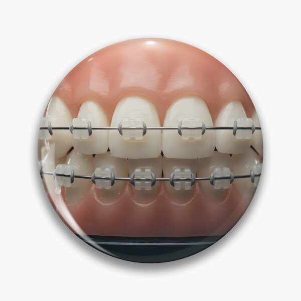 Item preview, Close-up of Teeth with Orthodontic Braces designed and sold by homydesign.