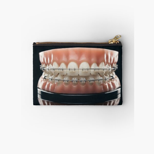 Item preview, Close-up of Teeth with Orthodontic Braces designed and sold by homydesign.
