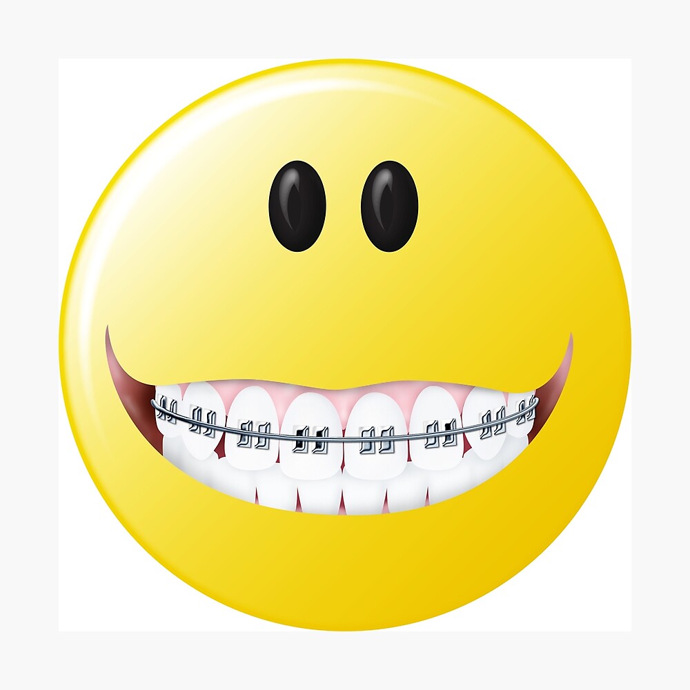 Albums 104+ Images Can You Have A Smiley Piercing With Braces Excellent