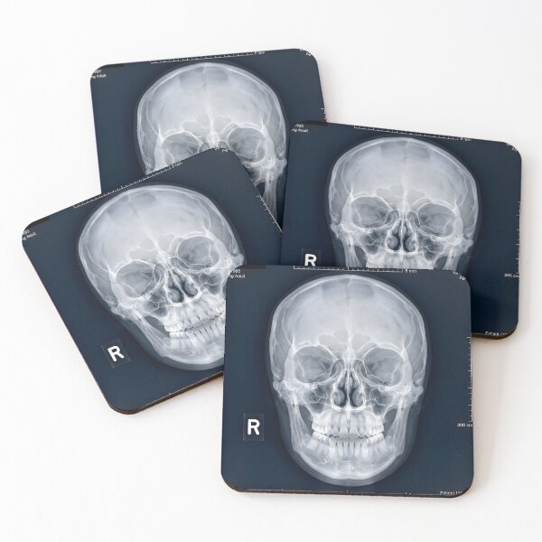 Item preview, Human Skull X-Ray Medical Radiography Art designed and sold by Sybille-Yates.