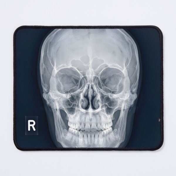 Item preview, Human Skull X-Ray Medical Radiography Art designed and sold by Sybille-Yates.