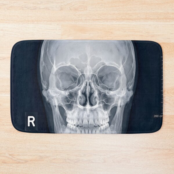 Item preview, Human Skull X-Ray Medical Radiography Art designed and sold by Sybille-Yates.