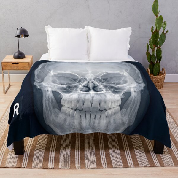 Item preview, Human Skull X-Ray Medical Radiography Art designed and sold by Sybille-Yates.