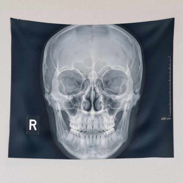 Item preview, Human Skull X-Ray Medical Radiography Art designed and sold by Sybille-Yates.