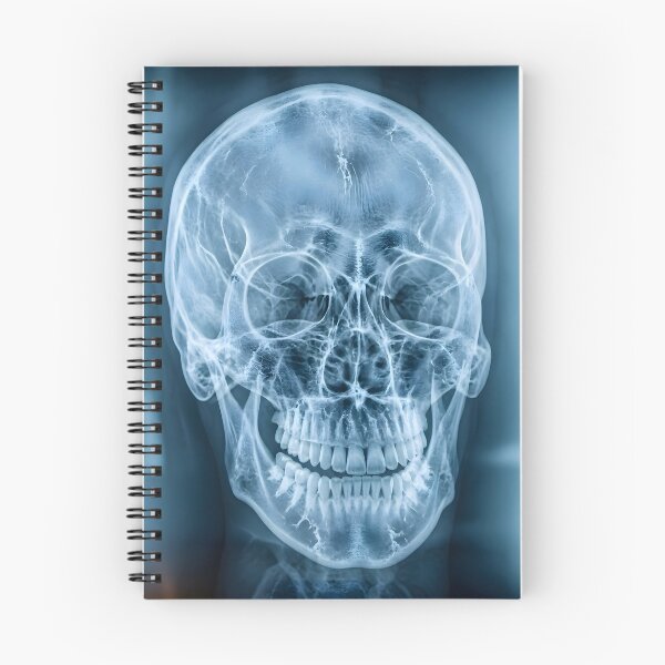 Item preview, Human Skull X-Ray Medical Radiography Art designed and sold by Sybille-Yates.