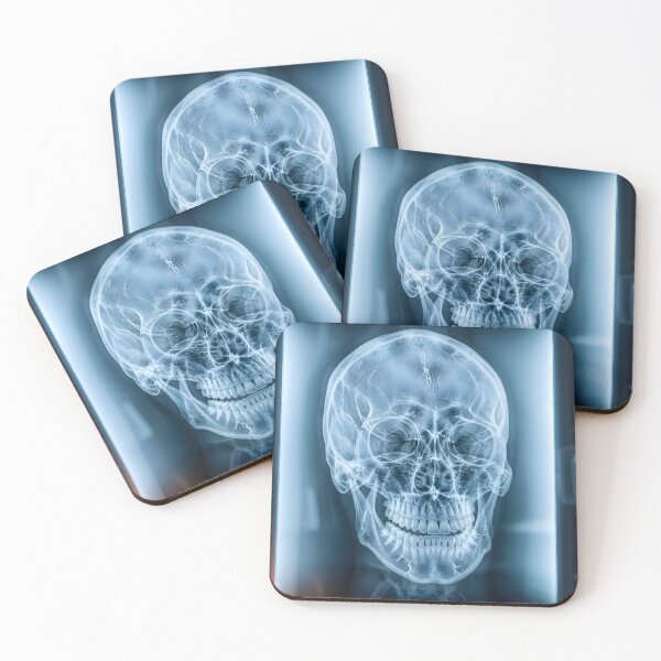 Item preview, Human Skull X-Ray Medical Radiography Art designed and sold by Sybille-Yates.