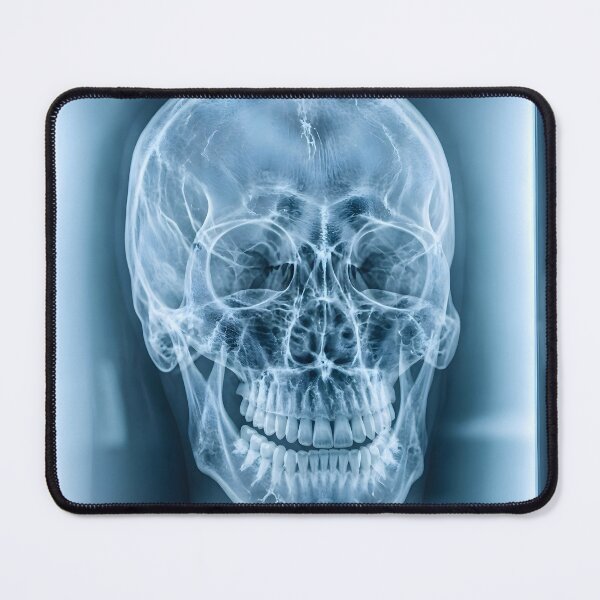 Item preview, Human Skull X-Ray Medical Radiography Art designed and sold by Sybille-Yates.