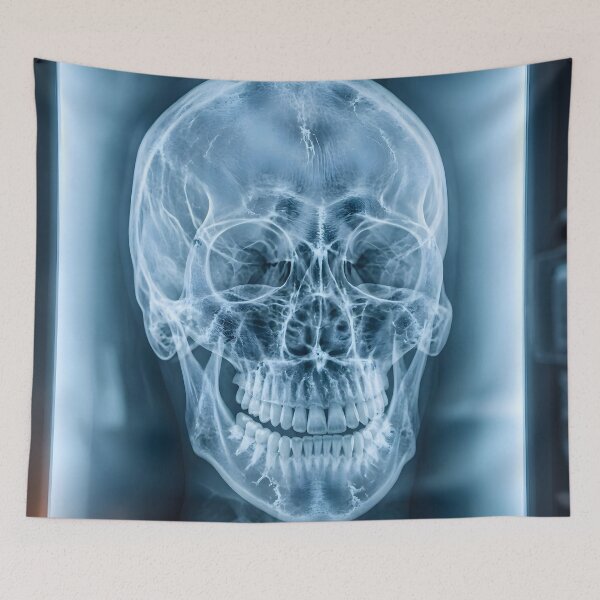 Item preview, Human Skull X-Ray Medical Radiography Art designed and sold by Sybille-Yates.