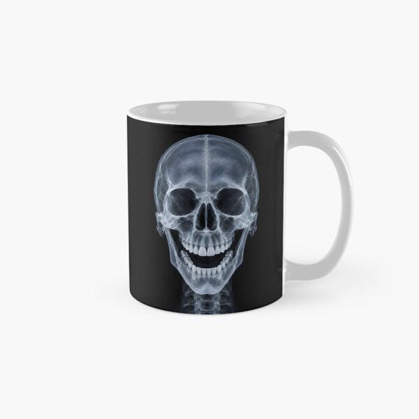 Item preview, Laughing Human Skull X-Ray Medical Radiography Art designed and sold by Sybille-Yates.