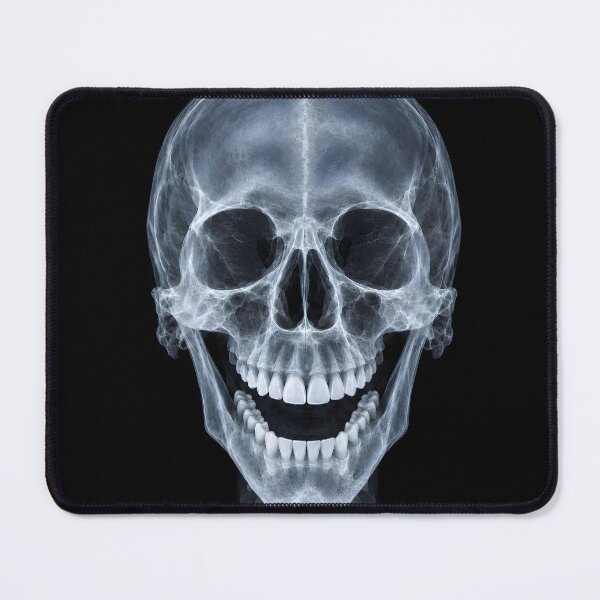 Item preview, Laughing Human Skull X-Ray Medical Radiography Art designed and sold by Sybille-Yates.