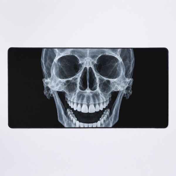 Item preview, Laughing Human Skull X-Ray Medical Radiography Art designed and sold by Sybille-Yates.
