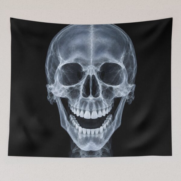 Item preview, Laughing Human Skull X-Ray Medical Radiography Art designed and sold by Sybille-Yates.