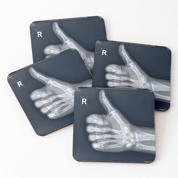 Item preview, Thumbs Up Hand X-Ray Skeleton Gesture designed and sold by Sybille-Yates.